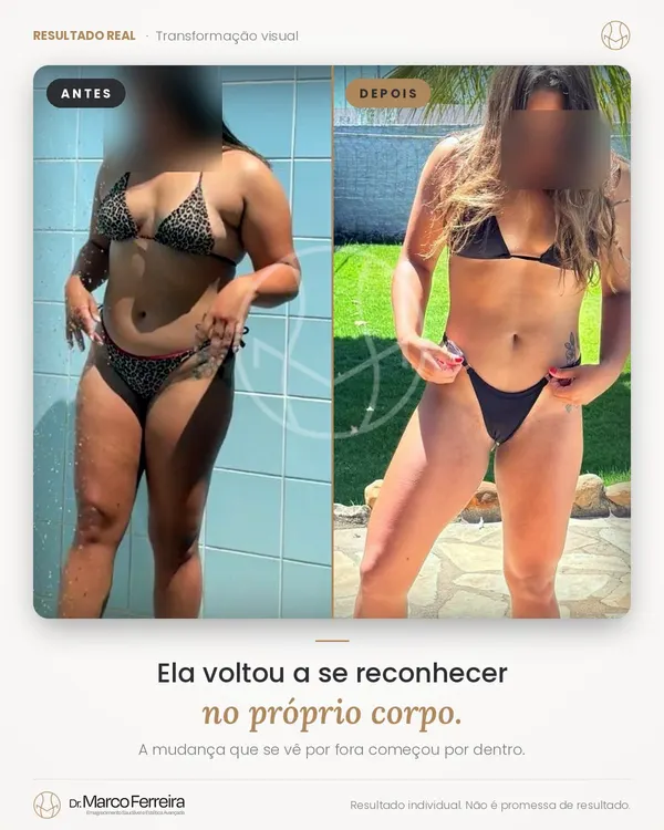 Antes e depois: Ela voltou a se reconhecer no próprio corpo. A mudança que se vê por fora começou por dentro.