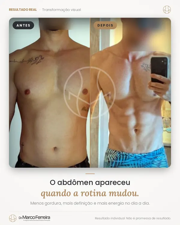 Antes e depois: O abdômen apareceu quando a rotina mudou. Menos gordura, mais definição e mais energia no dia a dia.