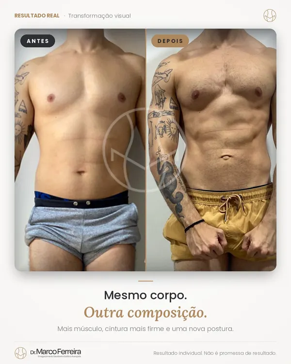 Antes e depois: Mesmo corpo. Outra composição. Mais músculo, cintura mais firme e uma nova postura.