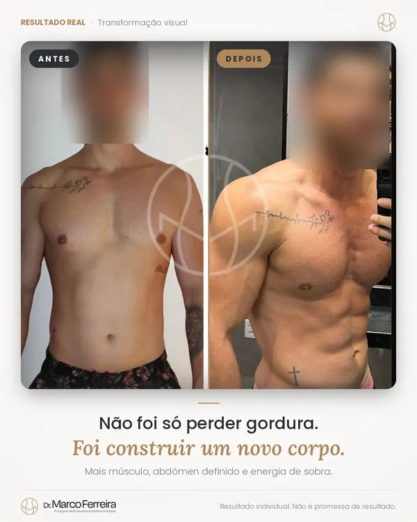 Antes e depois: Não foi só perder gordura. Foi construir um novo corpo. Mais músculo, abdômen definido e energia de sobra.