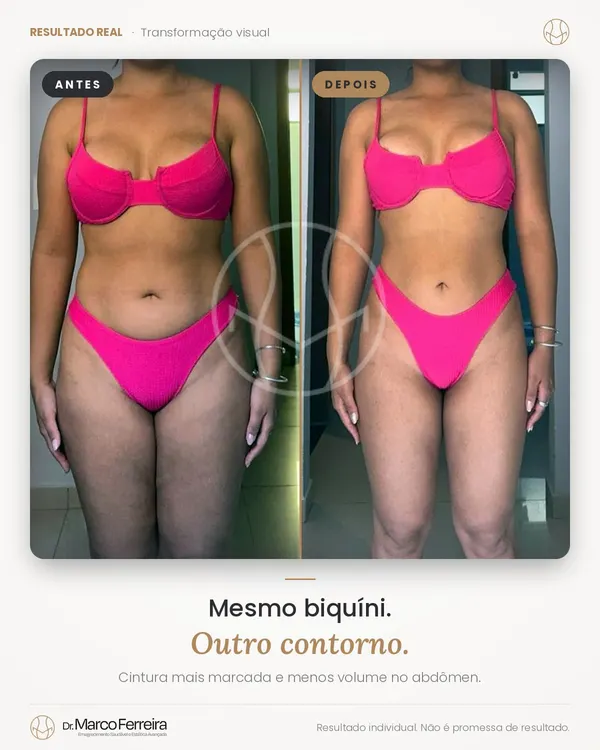 Antes e depois: Mesmo biquíni. Outro contorno. Cintura mais marcada e menos volume no abdômen.
