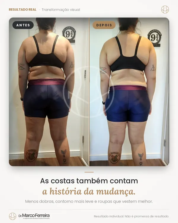Antes e depois: As costas também contam a história da mudança. Menos dobras, contorno mais leve e roupas que vestem melhor.