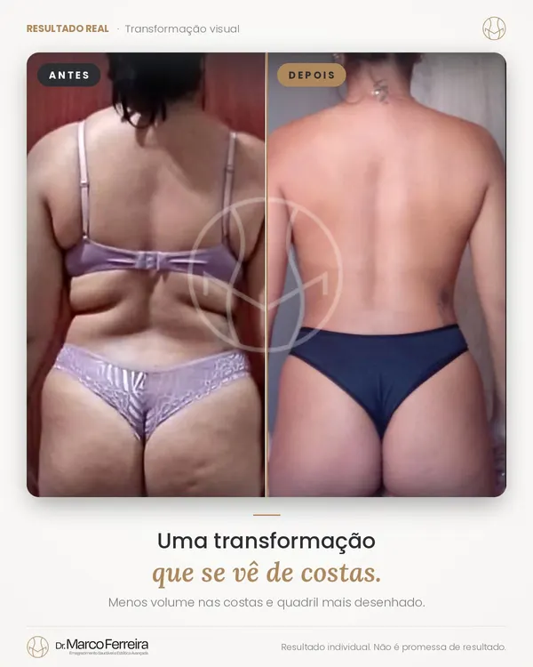 Antes e depois: Uma transformação que se vê de costas. Menos volume nas costas e quadril mais desenhado.