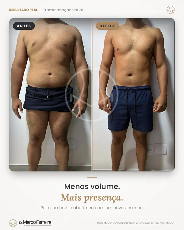 Antes e depois: Menos volume. Mais presença. Peito, ombros e abdômen com um novo desenho.