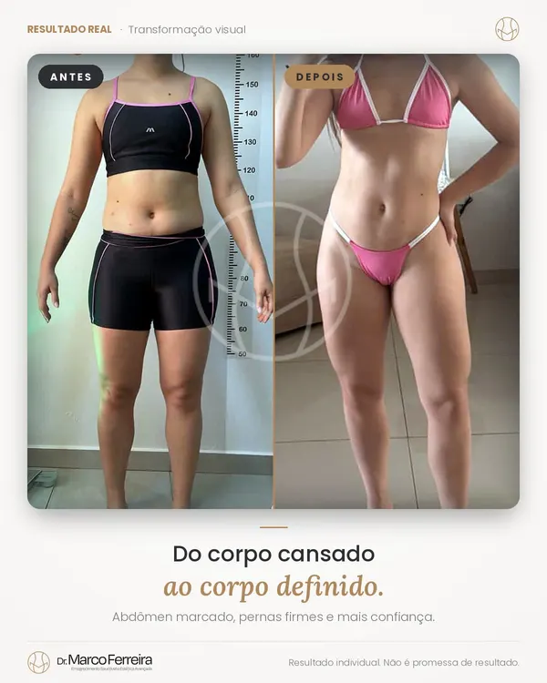 Antes e depois: Do corpo cansado ao corpo definido. Abdômen marcado, pernas firmes e mais confiança.
