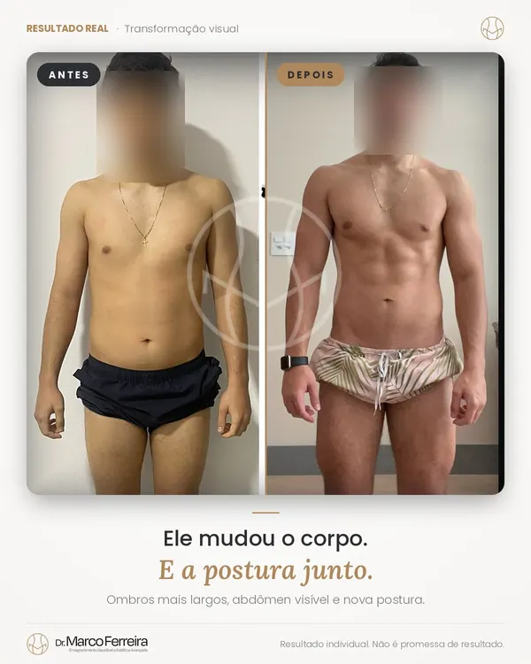 Antes e depois: Ele mudou o corpo. E a postura junto. Ombros mais largos, abdômen visível e nova postura.