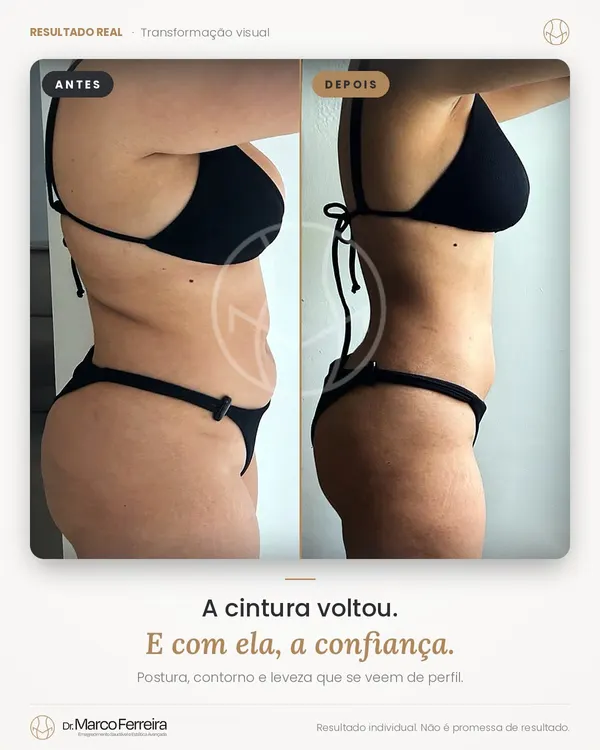Antes e depois: A cintura voltou. E com ela, a confiança. Postura, contorno e leveza que se veem de perfil.