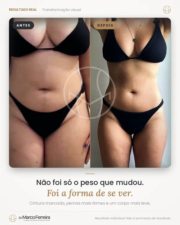 Antes e depois: Não foi só o peso que mudou. Foi a forma de se ver. Cintura marcada, pernas mais firmes e um corpo mais leve.